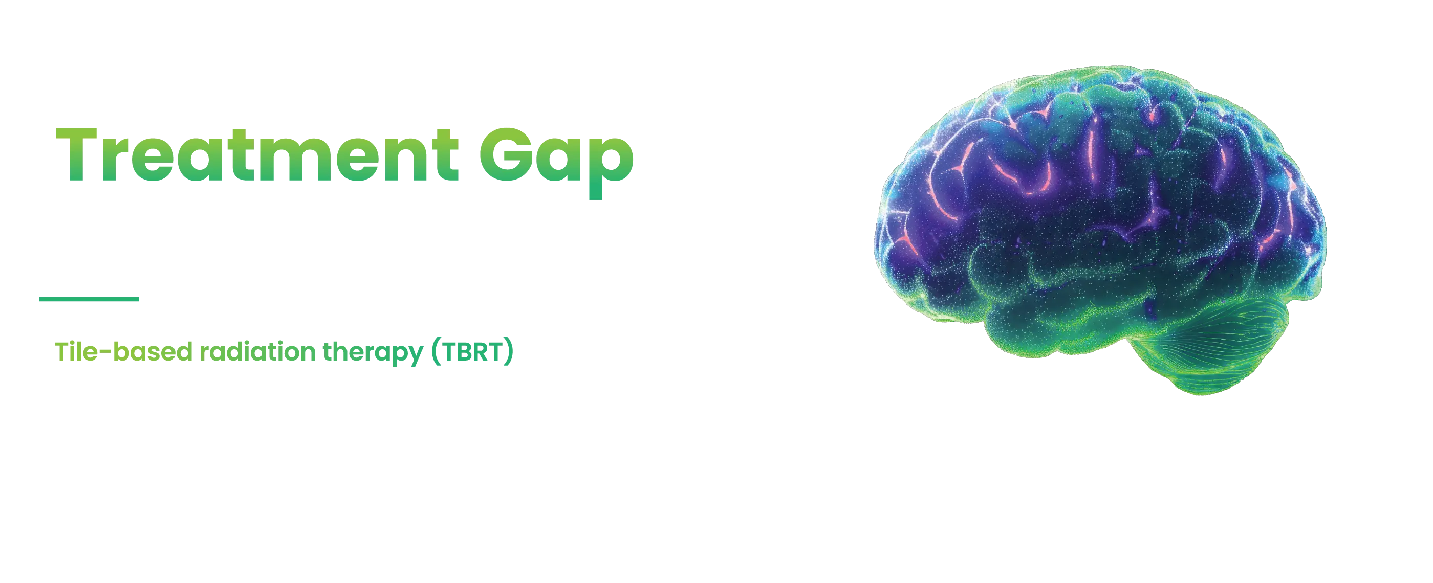Closing the Treatment Gap in Brain Metastases. Tile-based radiation therapy (TBRT) delivered at the time of surgical resection eliminates the traditional post-operative treatment gap.*
